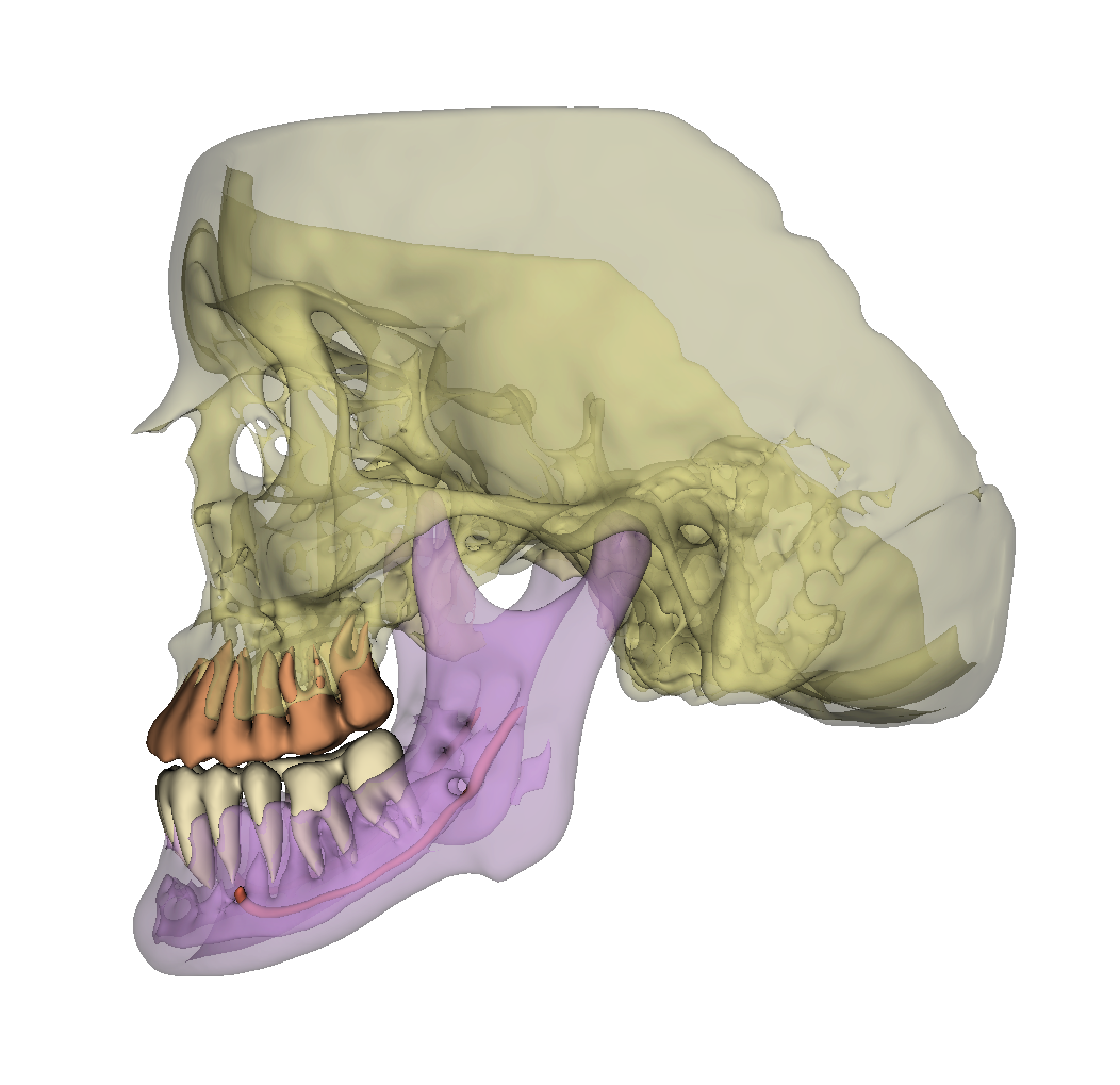 Fully automatic segmentation of anatomical structures in maxillofacial CBCT and multi-slice CT scans.